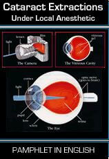 Cataract Extractions